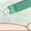 Prevenção de picadas de mosquito