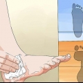 Resolvendo problemas com pés chatos