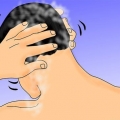 Usando rogaine ou minoxidil