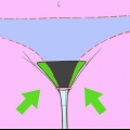 Remova os pelos pubianos ao redor da vagina
