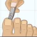 Esconder unhas fúngicas
