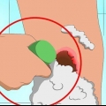 Livre-se das crostas de acne rapidamente