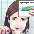 Clareamento dental com peróxido de hidrogênio