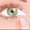 Descubra se você tem ácaros nos olhos