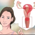 Diagnóstico de corrimento vaginal