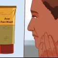 Livre-se de uma espinha com gel de aloe vera