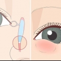 Como se livrar de um ducto lacrimal entupido