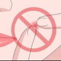 Evitando o desenvolvimento de uma espinha