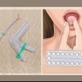 Saiba por que você não menstrua mais