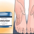 Trate o eczema de inverno