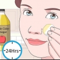 Remover verrugas no rosto
