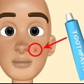 Faça seu próprio tratamento para acne