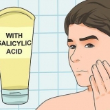 Tratamento da acne (para meninos adolescentes)