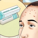 Livre-se da acne na testa