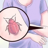 Tratamento de picadas de percevejos