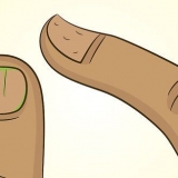 Curar unhas danificadas