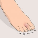 Usando fita adesiva para um dedo do pé lesionado