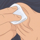 Cure inchaços na cartilagem ao redor do seu piercing