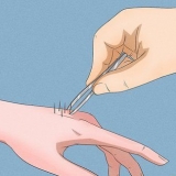 Remover agulhas de cacto