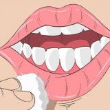 Curas esfoliativas para queilite
