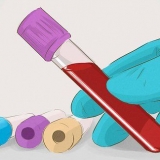 Aumento da taxa de filtração glomerular