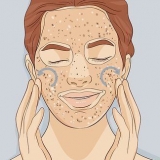 Esfoliar a pele