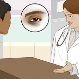 Melhore a pele sob os olhos