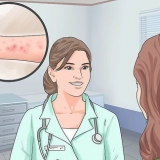 Aliviando os sintomas da dermatite espongiótica