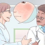 Tratamento de eczema no rosto