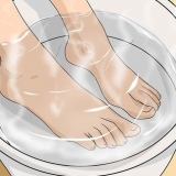 Remover calos