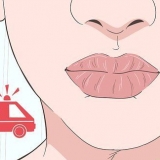 Cure uma queimadura em seus lábios