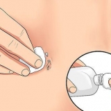 Tratando um piercing no umbigo irritado