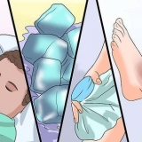 Curando um hematoma