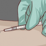 Lendo um teste cutâneo para tuberculose