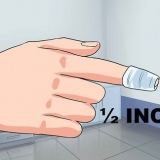 Tratando uma unha encravada