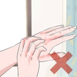 Reconhecendo uma infecção fúngica