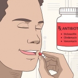 Tratando uma infecção da glândula salivar