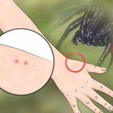 Identificando uma picada de aranha
