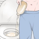 Troca de bolsa de ostomia