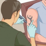 Remover uma tatuagem