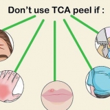 Aplicando um peeling de tca
