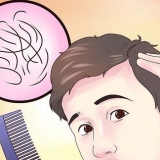 Descubra se você está ficando careca