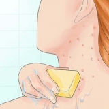 Tratamento da foliculite