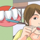 Remova o amarelo entre os dentes