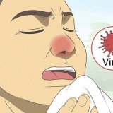 Reconhecendo a diferença entre amigdalite bacteriana e viral