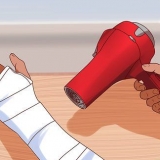 Você coça quando está coçando sob o gesso