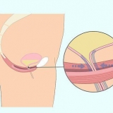 Faça exercícios de kegel