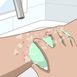 Tratamento de picadas de mosquito