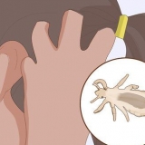 Prevenção de piolhos