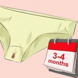 Prevenir o sangramento de escape com contracepção